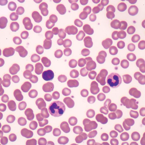 Slide, Blood Human Smear (Each)