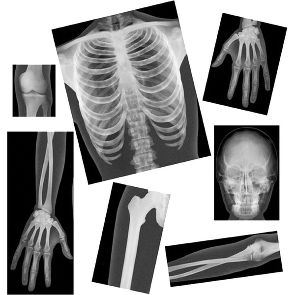 True-to-Life-Human-X-Rays-pk-18