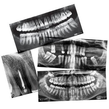 DENTAL X-RAYS, Age 5+, Set