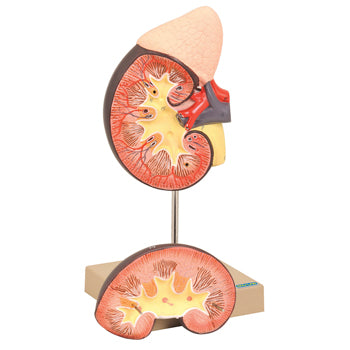 Model Kidney with Adrenal Gland - 2 Parts, Each